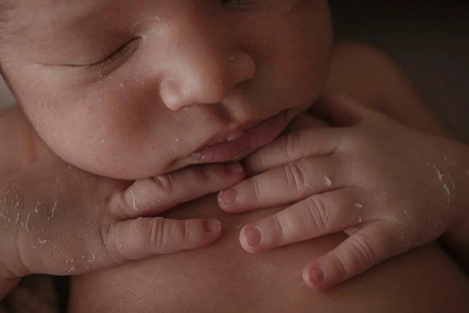 Dấu hiệu bệnh sởi ở trẻ dưới 1 tuổi cùng cách điều trị và chăm sóc