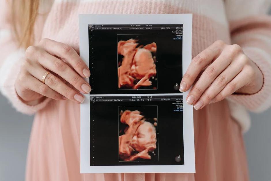 Hướng dẫn 3 cách tính ngày dự sinh chính xác nhất cho mẹ bầu: Từ chu kỳ kinh, siêu âm đến công cụ online